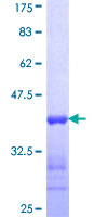 ACMSD Protein - 12.5% SDS-PAGE Stained with Coomassie Blue.