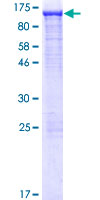 ACO1 / Aconitase Protein - 12.5% SDS-PAGE of human ACO1 stained with Coomassie Blue