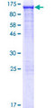 ACO1 / Aconitase Protein - 12.5% SDS-PAGE of human ACO1 stained with Coomassie Blue