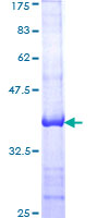 ACO1 / Aconitase Protein - 12.5% SDS-PAGE Stained with Coomassie Blue.