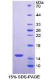 ACO1 / Aconitase Protein - Recombinant Aconitase 1 By SDS-PAGE