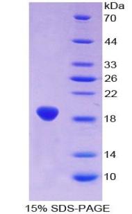 ACO1 / Aconitase Protein - Recombinant Aconitase 1 By SDS-PAGE