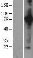 ACO2 / Aconitase 2 Protein - Western validation with an anti-DDK antibody * L: Control HEK293 lysate R: Over-expression lysate
