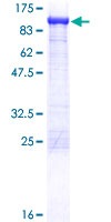 ACO2 / Aconitase 2 Protein - 12.5% SDS-PAGE of human ACO2 stained with Coomassie Blue