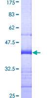 ACOT11 / THEA Protein - 12.5% SDS-PAGE Stained with Coomassie Blue.
