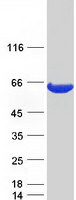 ACOT12 Protein - Purified recombinant protein ACOT12 was analyzed by SDS-PAGE gel and Coomassie Blue Staining