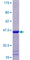 ACOT13 / THEM2 Protein - 12.5% SDS-PAGE of human THEM2 stained with Coomassie Blue