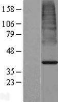 ACOT7 / BACH Protein - Western validation with an anti-DDK antibody * L: Control HEK293 lysate R: Over-expression lysate