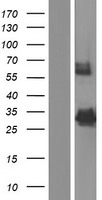 ACOT8 Protein - Western validation with an anti-DDK antibody * L: Control HEK293 lysate R: Over-expression lysate