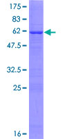 ACOT8 Protein - 12.5% SDS-PAGE of human ACOT8 stained with Coomassie Blue