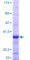 ACOT8 Protein - 12.5% SDS-PAGE Stained with Coomassie Blue.