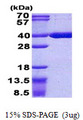 ACOT8 Protein