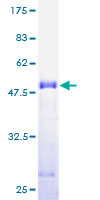 ACOT9 Protein - 12.5% SDS-PAGE of human ACATE2 stained with Coomassie Blue