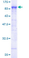 ACOX1 / ACOX Protein - 12.5% SDS-PAGE of human ACOX1 stained with Coomassie Blue