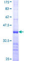 ACOX2 Protein - 12.5% SDS-PAGE Stained with Coomassie Blue.