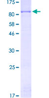 ACOX3 Protein - 12.5% SDS-PAGE of human ACOX3 stained with Coomassie Blue