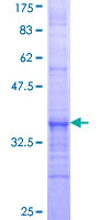 ACOX3 Protein - 12.5% SDS-PAGE Stained with Coomassie Blue.
