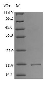ACP1 / Acid Phosphatase Protein - (Tris-Glycine gel) Discontinuous SDS-PAGE (reduced) with 5% enrichment gel and 15% separation gel.