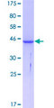 ACP1 / Acid Phosphatase Protein - 12.5% SDS-PAGE of human ACP1 stained with Coomassie Blue