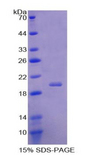 ACP1 / Acid Phosphatase Protein - Recombinant Acid Phosphatase 1 By SDS-PAGE