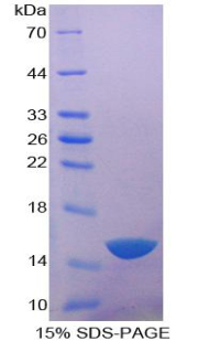 ACP1 / Acid Phosphatase Protein - Recombinant Acid Phosphatase 1 By SDS-PAGE