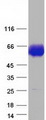 ACP2 / Acid Phosphatase 2 Protein - Purified recombinant protein ACP2 was analyzed by SDS-PAGE gel and Coomassie Blue Staining