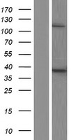 ACP5 / TRAP Protein - Western validation with an anti-DDK antibody * L: Control HEK293 lysate R: Over-expression lysate