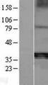 ACP5 / TRAP Protein - Western validation with an anti-DDK antibody * L: Control HEK293 lysate R: Over-expression lysate