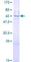 ACP5 / TRAP Protein - 12.5% SDS-PAGE of human ACP5 stained with Coomassie Blue