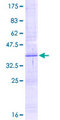 ACP5 / TRAP Protein - 12.5% SDS-PAGE Stained with Coomassie Blue.