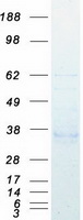 ACP5 / TRAP Protein - Purified recombinant protein ACP5 was analyzed by SDS-PAGE gel and Coomassie Blue Staining