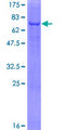 ACP6 Protein - 12.5% SDS-PAGE of human ACP6 stained with Coomassie Blue