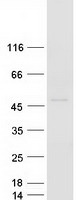 ACP6 Protein - Purified recombinant protein ACP6 was analyzed by SDS-PAGE gel and Coomassie Blue Staining