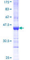 AcPL / IL18RAP Protein - 12.5% SDS-PAGE Stained with Coomassie Blue.