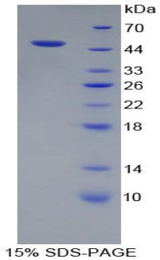 AcPL / IL18RAP Protein - Recombinant Interleukin 18 Receptor Accessory Protein By SDS-PAGE
