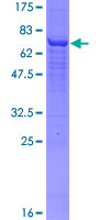 ACPP / PAP Protein - 12.5% SDS-PAGE of human ACPP stained with Coomassie Blue
