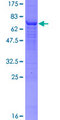 ACPP / PAP Protein - 12.5% SDS-PAGE of human ACPP stained with Coomassie Blue