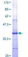 ACPP / PAP Protein - 12.5% SDS-PAGE Stained with Coomassie Blue.