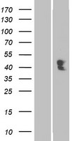 ACPT Protein - Western validation with an anti-DDK antibody * L: Control HEK293 lysate R: Over-expression lysate