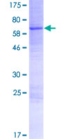 ACPT Protein - 12.5% SDS-PAGE of human ACPT stained with Coomassie Blue