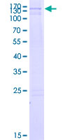 ACRC Protein - 12.5% SDS-PAGE of human ACRC stained with Coomassie Blue