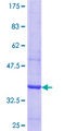 ACRC Protein - 12.5% SDS-PAGE Stained with Coomassie Blue.