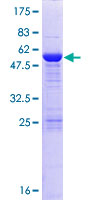 ACRP / SPAG7 Protein - 12.5% SDS-PAGE of human SPAG7 stained with Coomassie Blue