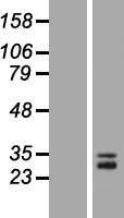 ACRV1/Intra-Acrosomal Protein Protein - Western validation with an anti-DDK antibody * L: Control HEK293 lysate R: Over-expression lysate