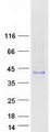 ACRV1/Intra-Acrosomal Protein Protein - Purified recombinant protein ACRV1 was analyzed by SDS-PAGE gel and Coomassie Blue Staining