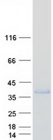 ACRV1/Intra-Acrosomal Protein Protein - Purified recombinant protein ACRV1 was analyzed by SDS-PAGE gel and Coomassie Blue Staining