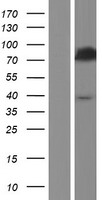 ACS5 / ACSL5 Protein - Western validation with an anti-DDK antibody * L: Control HEK293 lysate R: Over-expression lysate
