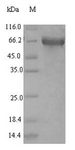 ACS5 / ACSL5 Protein - (Tris-Glycine gel) Discontinuous SDS-PAGE (reduced) with 5% enrichment gel and 15% separation gel.
