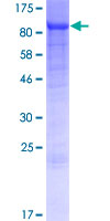 ACS5 / ACSL5 Protein - 12.5% SDS-PAGE of human ACSL5 stained with Coomassie Blue