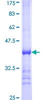 ACS5 / ACSL5 Protein - 12.5% SDS-PAGE Stained with Coomassie Blue